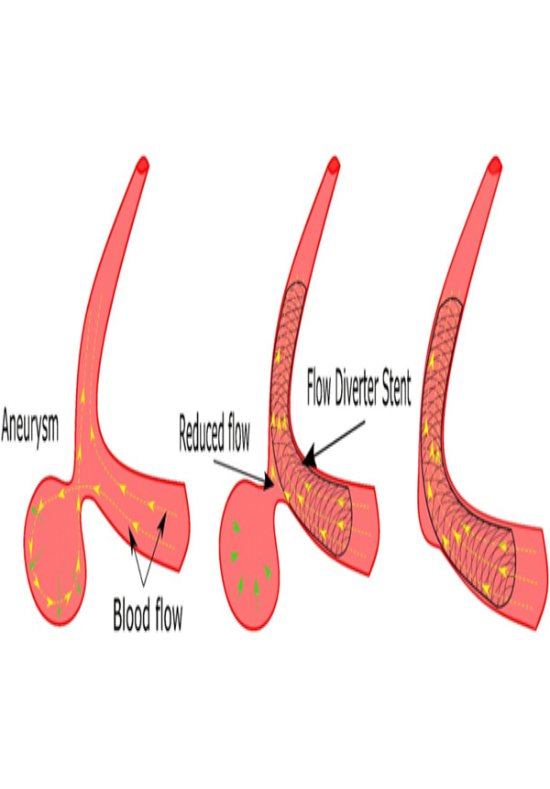 Interventional Radiology Equipment